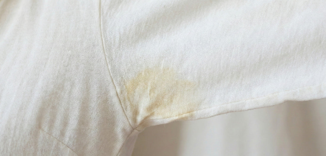 How to remove yellow stains from vintage white clothing without damaging the fabric